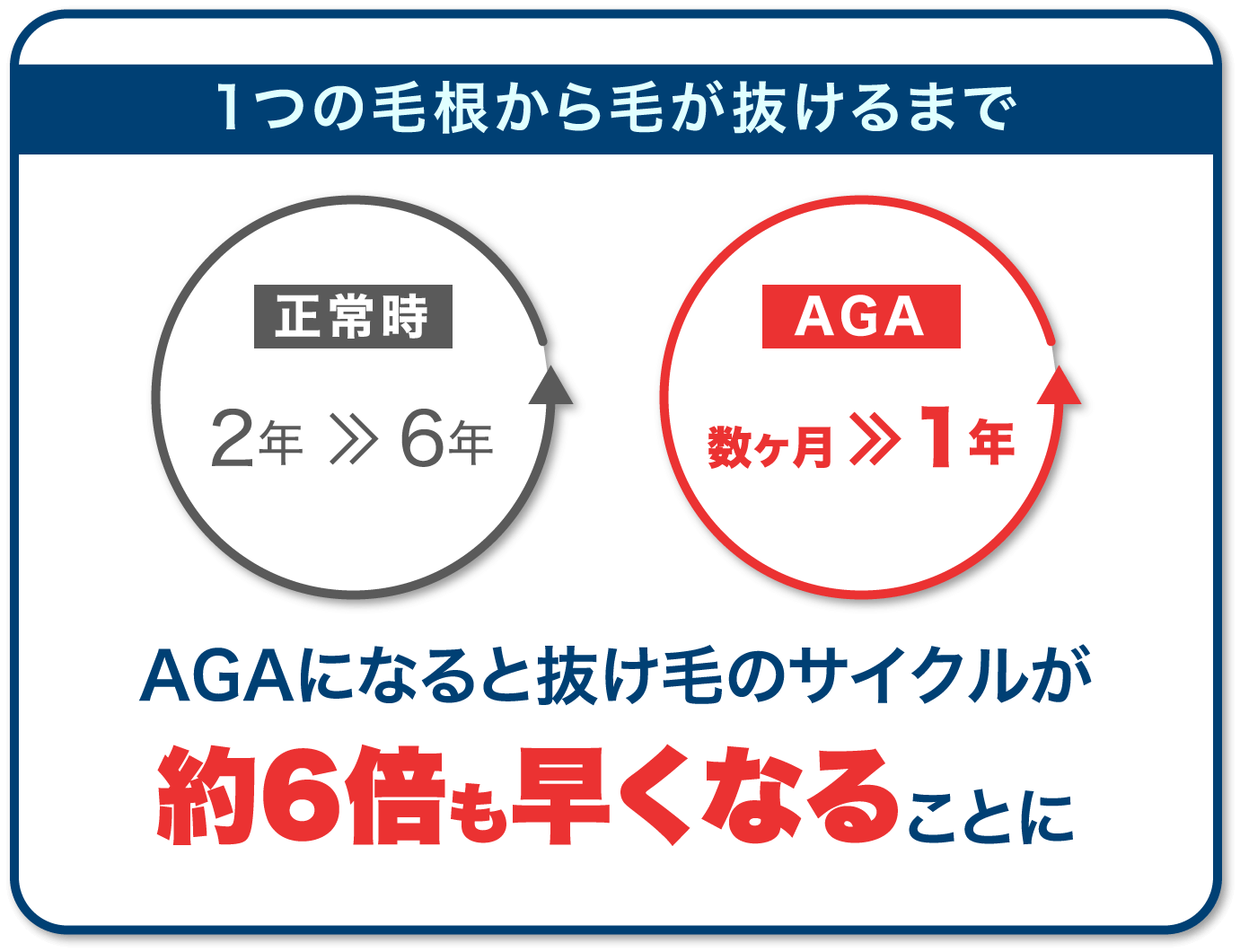 AGAになると抜け毛のサイクルが約6倍も早くなることに